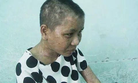 Lời kể rùng rợn của cô gái nghi bị chủ tra tấn dã man như thời trung cổ